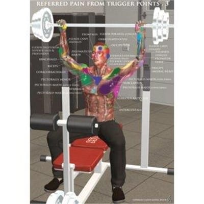 Fitness Mania - Referred Pain From Trigger Points Poster 3